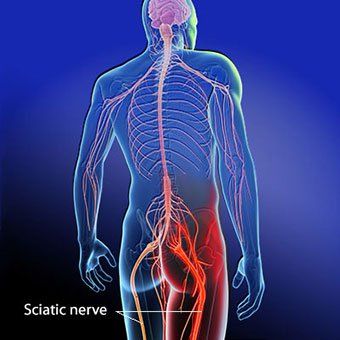 How Massage Therapy Can Ease Sciatic Pain